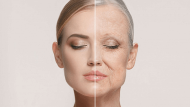 Skin Aging