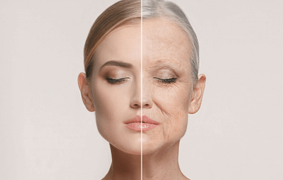 Skin Aging