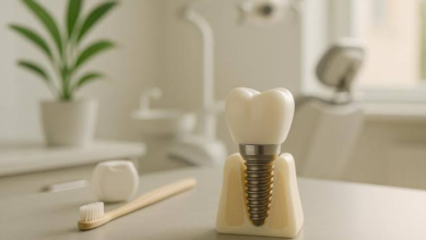 The Overlooked Factors That Shape A Successful Implant Experience
